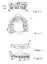 Fig. 02 - Procedure and device for enabling a dental element to be applied to a dental arch
