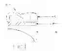 Fig. 02 - Dynamic dental crown