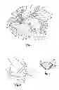 Fig. 02 - Post-operative brassiere