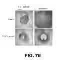 Fig. 14 - Contraceptive methods and compositions