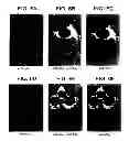 Fig. 09 - UCP4