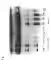 Fig. 08 - Equol-containing extract, method for production thereof, method for extraction of equol, and equol-containing food
