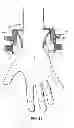 Fig. 12 - Surgical hand access apparatus