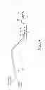 Fig. 06 - Sensing Foley catheter