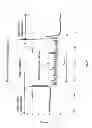 Fig. 09 - Sensing Foley catheter