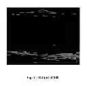 Fig. 08 - SYSTEMS AND METHODS FOR COMPOSITE MYOCARDIAL ELASTOGRAPHY