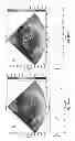 Fig. 137 - SYSTEMS AND METHODS FOR COMPOSITE MYOCARDIAL ELASTOGRAPHY