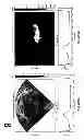 Fig. 149 - SYSTEMS AND METHODS FOR COMPOSITE MYOCARDIAL ELASTOGRAPHY