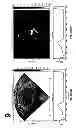 Fig. 166 - SYSTEMS AND METHODS FOR COMPOSITE MYOCARDIAL ELASTOGRAPHY