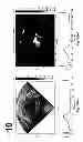 Fig. 167 - SYSTEMS AND METHODS FOR COMPOSITE MYOCARDIAL ELASTOGRAPHY