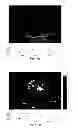 Fig. 40 - SYSTEMS AND METHODS FOR COMPOSITE MYOCARDIAL ELASTOGRAPHY