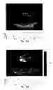 Fig. 41 - SYSTEMS AND METHODS FOR COMPOSITE MYOCARDIAL ELASTOGRAPHY