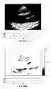 Fig. 43 - SYSTEMS AND METHODS FOR COMPOSITE MYOCARDIAL ELASTOGRAPHY