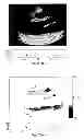 Fig. 46 - SYSTEMS AND METHODS FOR COMPOSITE MYOCARDIAL ELASTOGRAPHY