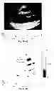 Fig. 47 - SYSTEMS AND METHODS FOR COMPOSITE MYOCARDIAL ELASTOGRAPHY