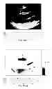 Fig. 48 - SYSTEMS AND METHODS FOR COMPOSITE MYOCARDIAL ELASTOGRAPHY