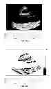 Fig. 67 - SYSTEMS AND METHODS FOR COMPOSITE MYOCARDIAL ELASTOGRAPHY