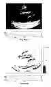 Fig. 71 - SYSTEMS AND METHODS FOR COMPOSITE MYOCARDIAL ELASTOGRAPHY