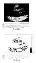 Fig. 72 - SYSTEMS AND METHODS FOR COMPOSITE MYOCARDIAL ELASTOGRAPHY