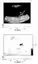 Fig. 74 - SYSTEMS AND METHODS FOR COMPOSITE MYOCARDIAL ELASTOGRAPHY