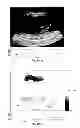 Fig. 76 - SYSTEMS AND METHODS FOR COMPOSITE MYOCARDIAL ELASTOGRAPHY