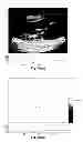 Fig. 87 - SYSTEMS AND METHODS FOR COMPOSITE MYOCARDIAL ELASTOGRAPHY