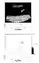 Fig. 97 - SYSTEMS AND METHODS FOR COMPOSITE MYOCARDIAL ELASTOGRAPHY