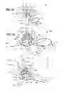 Fig. 06 - Axial Surgical Trajectory Guide