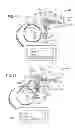 Fig. 07 - Axial Surgical Trajectory Guide