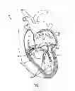 Fig. 02 - Independent gripper