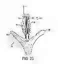 Fig. 15 - Independent gripper