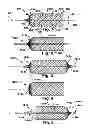 Fig. 02 - Method and apparatus for increasing blood flow through an obstructed blood vessel