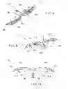 Fig. 05 - Endoscopic hemostasis closure device and delivery system