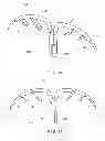 Fig. 08 - Endoscopic hemostasis closure device and delivery system