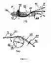 Fig. 07 - SUTURE BONE ANCHOR