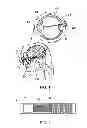Fig. 02 - Method and apparatus for stimulating retinal nerve cells