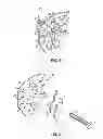 Fig. 02 - Pinion disassembly tool and method