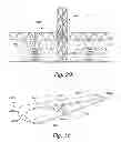 Fig. 22 - Method for erecting a facility producing electrical energy from wind