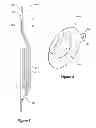 Fig. 07 - Fire suppression valve improvements