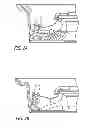 Fig. 03 - Aircraft tire pressure loop link