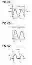 Fig. 09 - Failure detection device for vehicle speaker