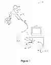 Fig. 02 - Endoscope connector method and apparatus