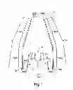 Fig. 02 - Apparatus for applying corrective forces to shape palate