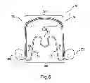 Fig. 07 - Apparatus for applying corrective forces to shape palate