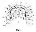 Fig. 09 - Apparatus for applying corrective forces to shape palate