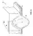 Fig. 04 - Metallurgical clamshell methods for micro land grid array fabrication