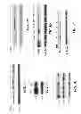Fig. 05 - Saposin-A derived peptides and uses thereof