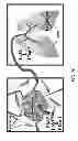 Fig. 13 - Saposin-A derived peptides and uses thereof