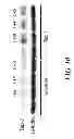 Fig. 16 - Saposin-A derived peptides and uses thereof