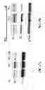 Fig. 21 - Saposin-A derived peptides and uses thereof